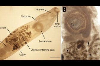 Girl Visits the Galápagos and All She Obtained Was This Unique Eye Parasite
