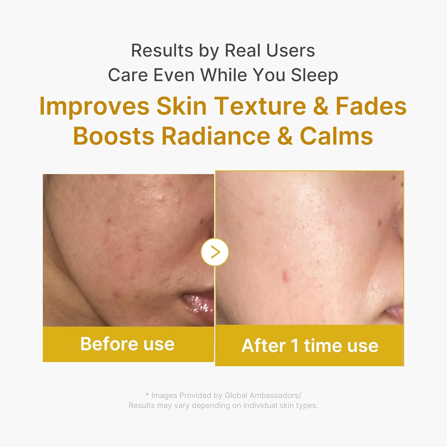 medicube Wrapping Masks Kojic Acid, Turmeric, Vitamin C In a single day Peel Off Facial Masks | Brighten & Defends Towards Pores and skin Stress for a Clear, Glowing Complexion | Korean Pores and skin Care, 2.53 fl.oz - Image 5