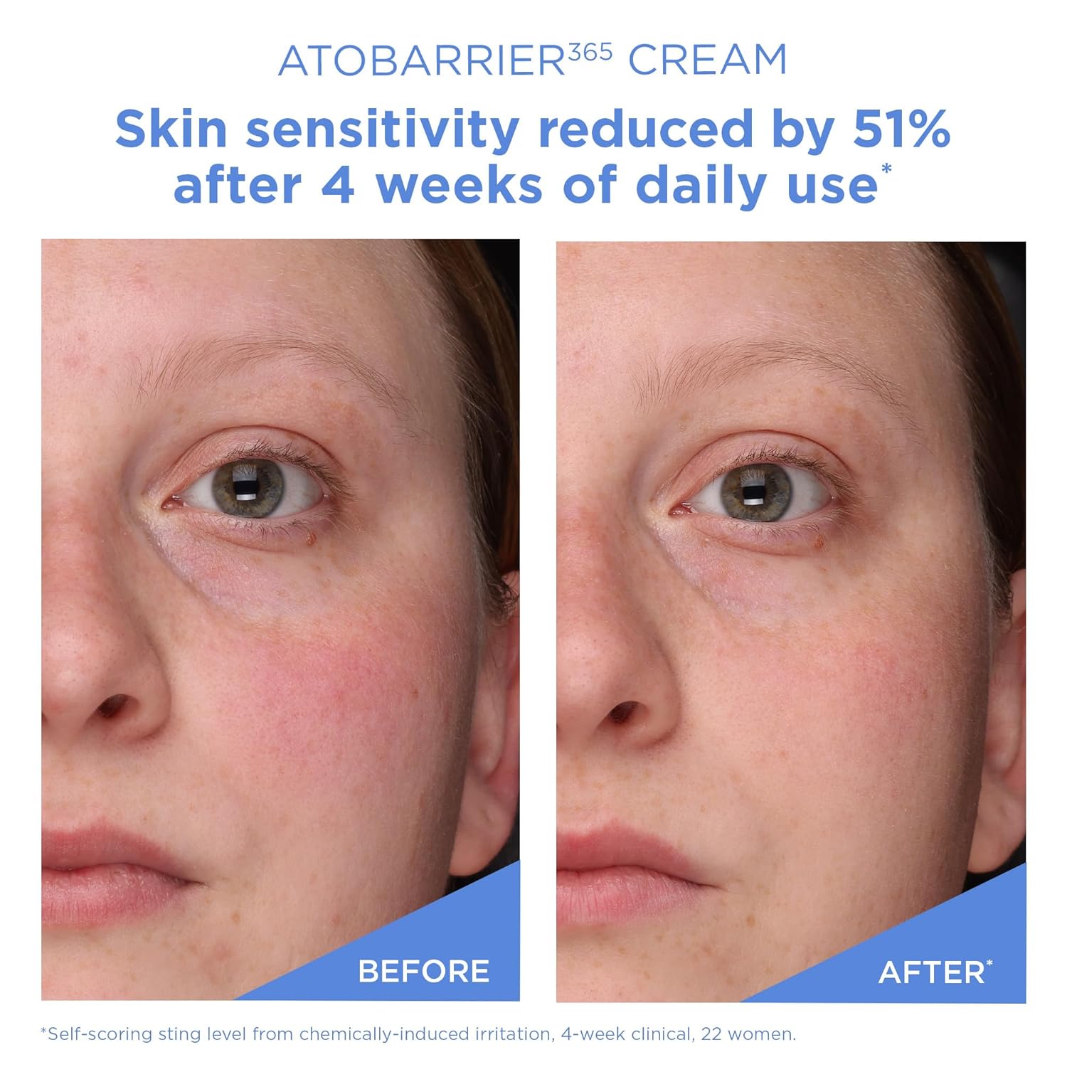 AESTURA ATOBARRIER365 Cream with Ceramides, Korean Face Moisturizer for Barrier Restore | 120H lasting Hydration, Ceramide Capsules, Dry & Delicate Pores and skin, Non-comedogenic, 80 mL / 2.70 fl.oz. - Image 6