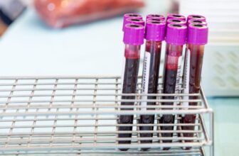 A Easy Blood Take a look at May Finally Inform You When Alzheimer’s Is Coming