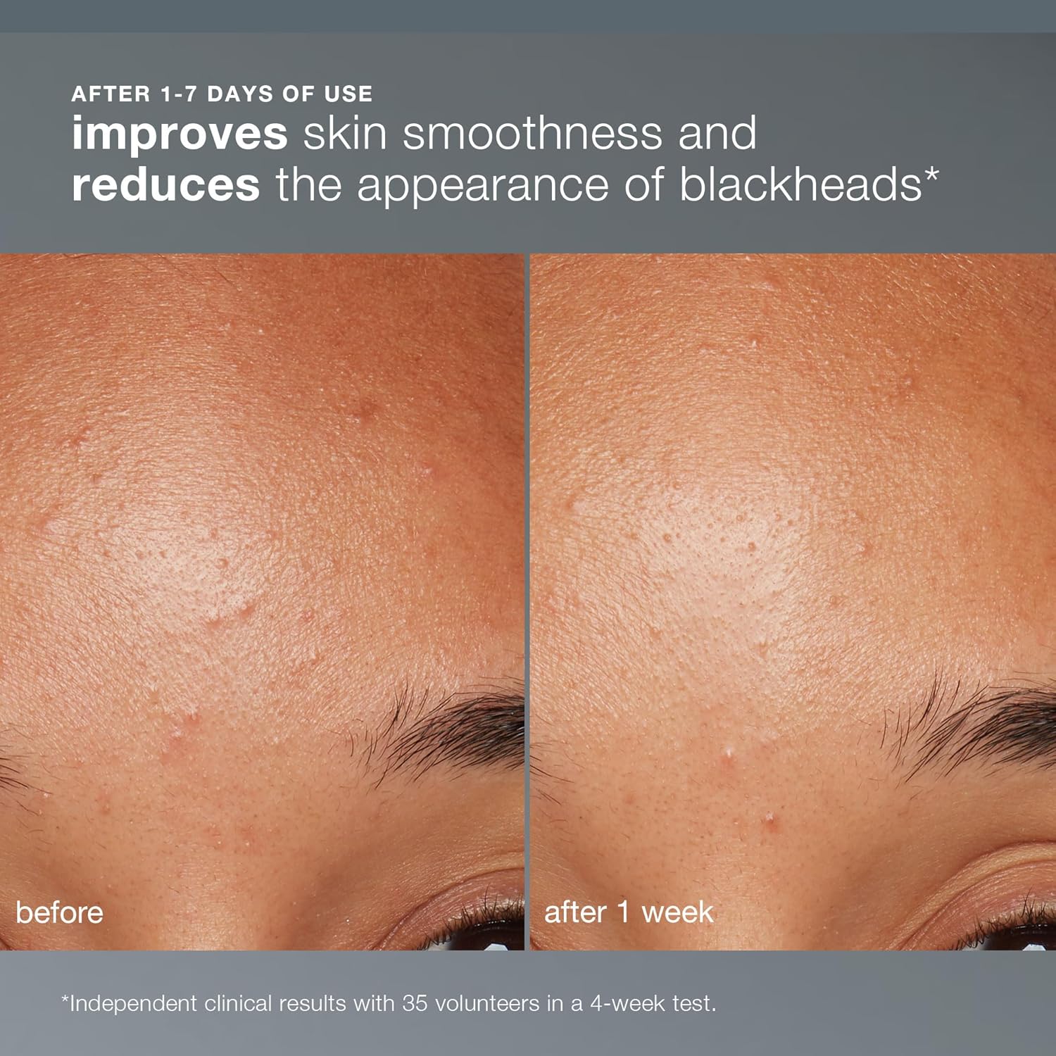 Dermalogica Each day Microfoliant, Face Exfoliator Scrub Powder with Salicylic Acid and Papaya Enzyme, Obtain Brighter, Smoother Pores and skin Each day - Image 3